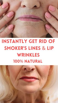 You Won't Believe How Easy It Is to Get Rid of Wrinkles Naturally >>CHECK THIS OUT<< Smokers Lines, Homemade Wrinkle Cream, Lip Wrinkles, Glow Skin, Wrinkled Skin