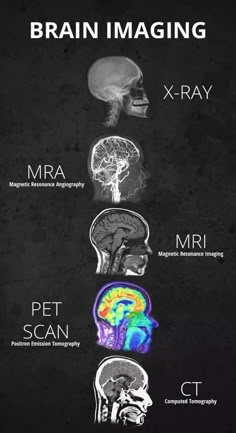 the brain is shown with different types of mris and their functions in each section