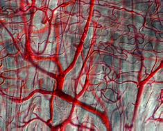 Tongue blood vessels, light micrograph. Blood vessels (red) range in size from larger arteries and veins, through smaller venules and arterioles, to tiny capillaries. Exam Photo, Elder Brain, Movie Lighting, The Bacchae, Exam Photos, Tell Tale Heart, Titus Andronicus, Self Insert, Arteries And Veins