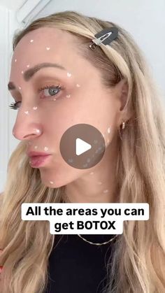 Botox For Downturned Mouth, Nose Tip Lift Botox Before And After, Botox Eye Lift, Bunny Lines Botox Before And After, Botox Jawline Before And After, Botox Eyes, Botox Under Eyes, Lines Around Mouth, Botox Forehead