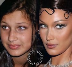 Jaw Reduction Surgery, Plastic Surgery Gone Wrong, Haircut For Face Shape, Celebs Without Makeup, Perfect Nose, Nose Surgery