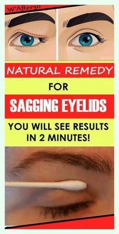 Eyelid Exercises, Gus Sha, Eye Wrinkles Remedies, Skin Tightening Face Mask, Skincare For Wrinkles, Tightening Face Mask, Dark Spots Remedies