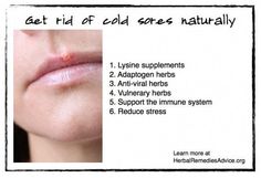 Get Rid Of Cold Sores Naturally - DIY #TipIt Cold Sore Stages, Natural Cold Sore Remedy, Stuffy Nose Remedy, Get Rid Of Cold, Fever Blister, Healing Remedies, Cold Sores Remedies