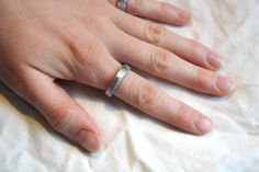 a woman's hand with two rings on it, resting on a white sheet