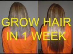 How to grow your hair in less than 1 week (Natural Fast Hair Growth remedy) - YouTube Hair Growth Remedy, Growing Long Natural Hair, Make Hair Grow Faster, Longer Hair Faster, Fast Hair Growth, Make Hair Grow, Hair Growth Secrets