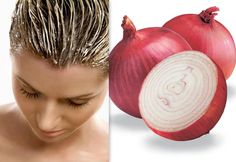 #Onion is an ingredient that plays a vital role in enhancing hair growth. Applying this #mask all over your #hair is a great choice! Help Hair Growth, Onion For Hair, Hair Issues, Grow Hair Faster, Hair Growth Faster, Hair Problems, Roots Hair, Shiny Hair