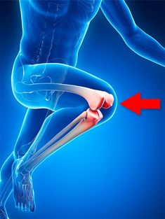 Knee pain: Symptoms, causes, treatment and relief Runners Knee, Knee Problem, Knee Exercises, Knee Pain Relief, Back Pain, Pain Relief, How Are You Feeling, Medical