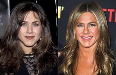 Top 25 Celebrities Before And After Plastic Surgery And Nose Jobs Nose Jobs Before And After, Nose Job Before And After, Celebrity Nose Jobs, Nose Jobs, Rhinoplasty Nose Jobs, Face Lift Surgery, Diy Crafts For Girls