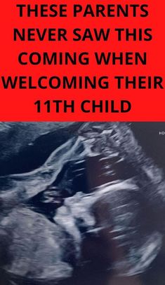 a poster with the words, these parents never saw this coming when we welcoming their 11th child