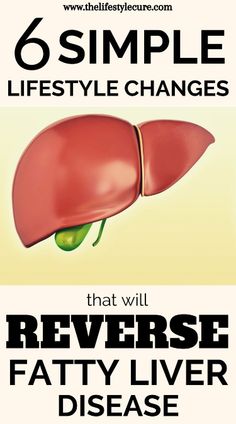 https://fitnessandfacts.com/ how to heal your liver, how to heal your liver naturally, foods to heal your liver, how to help heal your liver, how to heal and detoxify your liver, recipes to heal your liver, what to eat to heal your liver, foods to help heal your liver, healing foods for the liver, liver shrinking diet meal plan, Fatty Liver Treatment, Home Medicine, Chronic Disease