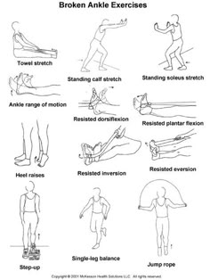 Broken Fibula, Ankle Sprain Recovery, Ankle Strength, Ankle Recovery