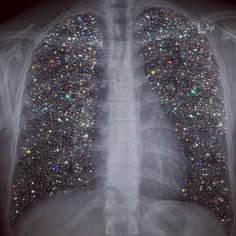 an x - ray shows the chest and lungs covered in multicolored glitters