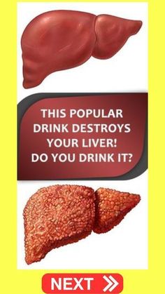 This Popular Drink Destroys Your Liver! Do You Drink It? Health Resolutions, Health Articles Wellness, Easy Healthy Meals, Chronic Kidney, Popular Drinks, Women Health Care