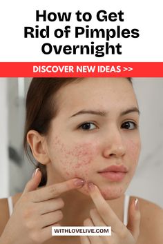 Struggling with pesky pimples? 🌙✨ Discover the ultimate guide to getting rid of them overnight! From natural remedies to effective treatments, this complete guide has you covered for clear skin fast. Don’t wait—save this pin for all the tips you need to wake up pimple-free! 💖📌 Get Rid Of Pimples Overnight, Rid Of Pimples Overnight, Inflamed Pimple, Pimple Solution, Pimple Causes, Clear Skin Fast, Get Rid Of Pimples, Rid Of Pimples, How To Reduce Pimples