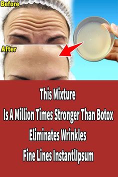 Discover a powerful natural mixture that is claimed to be more effective than Botox in reducing wrinkles and promoting smoother, youthful skin. Learn how simple ingredients can work together to rejuvenate your complexion without the need for invasive procedures. Remove Fine Lines And Wrinkles, How To Get Rid Of Forehead Lines, How To Get Rid Of Wrinkles On Forehead, Wrinkle Remedies Face, Forehead Wrinkles Remedies