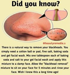 Haut Routine, Natural Skin Care Remedies, Natural Face Skin Care, Good Skin Tips, Perfect Skin Care Routine, Healthy Skin Tips, Skin Care Remedies, Skin Care Recipes, Natural Face