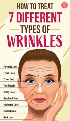 Nobody likes to have wrinkles on their face. But eventually, we’re all going to get a few lines because we are aging and nobody can stop time. Wrinkles Remedies Face, Marionette Lines, Wrinkle Remedies, Wrinkle Free Skin, Forehead Wrinkles, Skin Care Wrinkles, Baking Soda Shampoo, Face Wrinkles, Eye Wrinkle