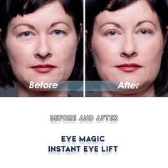 Eye Magic Original Instant Eye Lift Kit for just $19.95 Eyelash Growth, Age Defying, Eye Gel, Puffy Eyes