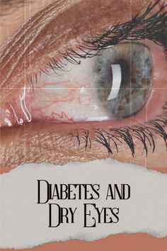 Join us on a fascinating exploration of the complex relationship between diabetes and dry eyes. We'll delve into the science behind this connection, share practical tips for managing both conditions, and provide inspiration for maintaining clear vision and overall health. Don't miss out on this essential guide to living your best life with both diabetes and dry eyes! Dry Eye Symptoms, Living Your Best Life, Natural Aging, Clear Vision, Overall Health