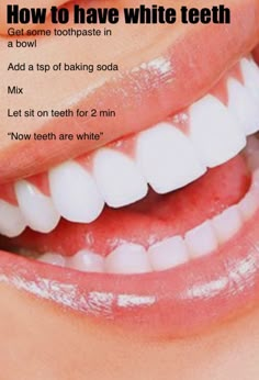 White Teeth Tips, Baking Soda Teeth, Baking Soda Teeth Whitening, Teeth Tips, Get Whiter Teeth, Teeth Whitening Homemade, Teeth Whitening Remedies, Teeth Whitening Diy, Glow Ups