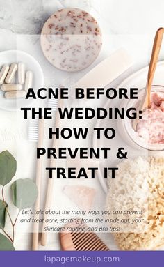 Let's talk about the many ways you can prevent and treat acne, starting from the inside out, your skincare routine, and pro tips! | skincare tips | acne treatment | acne skincare routine | acne scars remedies Skin Care Before Wedding, How To Fix Acne Scarring, How To Prevent Acne Scarring, How To Treat Acne Scaring, Active Acne Remedies, Makeup Looks For Blue Eyes, Perfect Makeup Look, Makeup Tips To Look Younger, Acne Scar Remedies