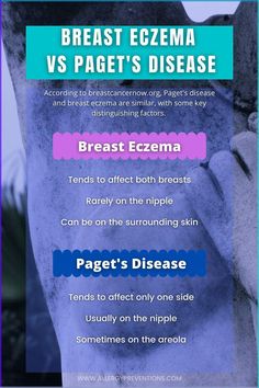 According to breastcancernow.org, Paget's disease and breast eczema are similar, with some key distinguishing factors. Learn more at allergypreventions.com #breasteczema #eczema #dermatitis #pagetsdisease #rash #allergypreventions Skin Rash On Face, Disease Infographic, Itchy Body, Pagets Disease, Rash On Face, Rash On Neck, Dry Itchy Skin, Dry Skin Patches