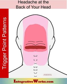 Headache at the base of your head - Integrative Works Therapist Notes, Forward Head Posture Exercises, Sinus Congestion Relief, Neck And Shoulder Muscles, Muscle Stretches, Forward Head Posture, Congestion Relief, Back Of Head