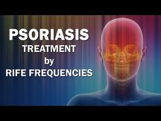 Rife Frequencies, Dental Infection, Heavy Metal Detox, Sciatica Relief, Solfeggio Frequencies, Sound Frequencies, Candida Albicans, Energy Medicine, Healing Frequencies