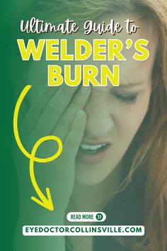 Flash Burns can cause severe pain and long-lasting damage, yet they remain under the radar. Learn essential facts about this often-overlooked form of skin injury, and how you could be at risk in everyday situations. Eye Irritation Remedies, Eye Health Facts, Eye Specialist, Eye Diseases, Bloodshot Eyes, Parts Of The Eye, Blurry Vision, Watery Eyes, Light Sensitivity