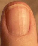 Ridges on nails mean you need vitamin B 12, and other things your nails may be telling you-- very informative article. Low Vitamin B12, Fingernail Health, Nail Health, Vitamin B12, Vitamin B, Natural Medicine