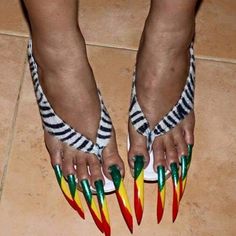 Trendy Nail Ideas Ugly Toenails, Feet Nail Design, Kutek Disney, Unghie Nail Art, Summer Toe Nails