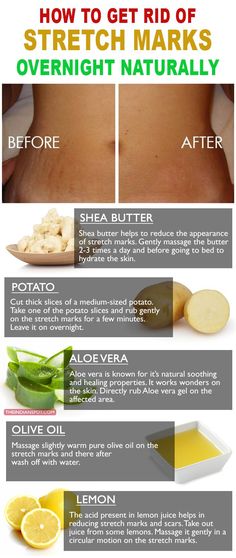 Natural Healing Remedies, Baking Soda Shampoo, Natural Therapy, Skin Healing, Natural Home Remedies, Skin Tips, Cleaning Tips, Natural Healing