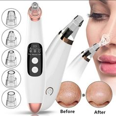 Blackhead Remover Machine Description: Compact Blackhead Clean Machine, Which Is A Beauty Instrument With Many Functions, Like Dermabrasion, Compact, Clean Pores, Acne Remove And Blackhead Suction. There Are 6 Different Sized Replacement Suckers, Which Can Be Adjusted According To Your Actual Needs. Pore Sucker, Acne Remove, Led Light Mask, Home Remedies For Pimples, Led Light Therapy Mask, Pmd Beauty, Pimples Overnight, Light Therapy Mask, Light Mask