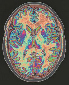 an image of the inside of a human brain