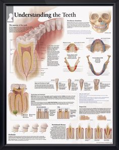 Teeth Chart, Educational Chart, Tooth Chart, Dental Implants Cost