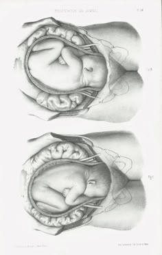 two drawings of hands holding a baby's head