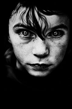 a black and white photo of a person with freckles on their face looking at the camera