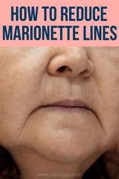 Lines Around Mouth, Marionette Lines, Face Yoga Exercises, Face Yoga Facial Exercises, Face Exercises, Saggy Skin