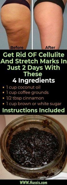 Resep Diet, Skincare Hacks, Trening Fitness, Natural Therapy, Beauty Tricks, Skin Care Remedies, Beauty Skin Care Routine, Health And Beauty Tips, Skin Tips