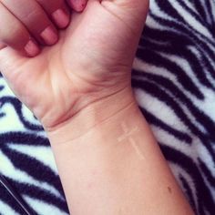 a person's arm and hand on top of a zebra print blanket