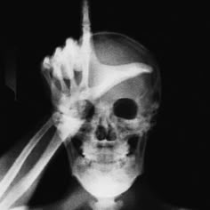 an x - ray image of a skeleton wearing a mask