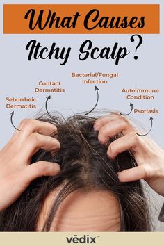 causes of itchy scalp Itching Scalp Remedies, Remedies For Itchy Scalp, Itching Remedies, Scalp Itch, Control Yourself, Hair Grow Faster, Itching Skin