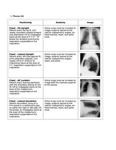 an x - ray shows the chest and chest with four different sections labeled in it