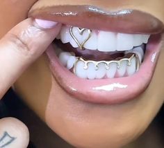 Jewelry Teeth, Teeth Caps, Teeth Whitening Remedies, Braces Colors