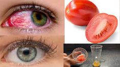 Improve Eyesight Naturally, Whiten Eyes, Best Eye Drops, To Improve Eyesight, Bad Eyesight, Cucumber And Tomato, Eye Sight