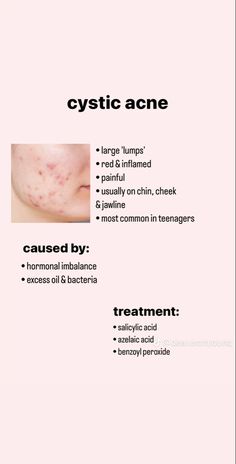 Dermatology Cheat Sheet, Skin Care By Dermatologist, Acne Infographic, Esthetician Skin Analysis, Esthetician Tips Facts Skin Care, Tighten Facial Skin, Skin Care Basics, Beauty Skin Quotes, Skin Therapist