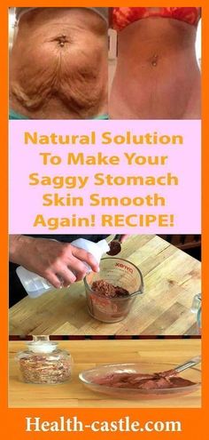 Tighten Loose Skin, Skin Bumps, Saggy Skin, Natural Health Tips, Loose Skin, Sagging Skin, Skin Tightening