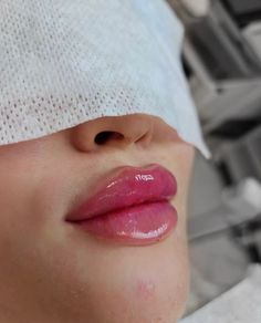 Liquid Rhinoplasty, Latina Aesthetic Hair, Lip Color Shades, Mouth Piercings, Lips Inspiration, Face Fillers, Botox Lips, Lipstick For Dark Skin, Facial Fillers