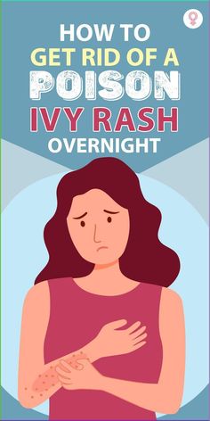 How To Get Rid Of A Poison Ivy Rash Overnight: While the rashes go away on their own in a few days, there are a few quick solutions that can help you get rid of a poison ivy rash overnight. In this article, we dive deeper into the causes and symptoms of poison ivy rash and natural remedies you can try at home. #poisonivy #remedies #homeremedies Poison Ivy On Face, Poison Ivy On Skin, Poison Sumac Rash, Poison Oak Remedies, How To Make Poison, Poison Oak Rash, Home Remedies For Rashes, Poison Ivy Relief, Kill Poison Ivy