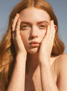 a woman with freckles on her face and hands near her face, looking at the camera